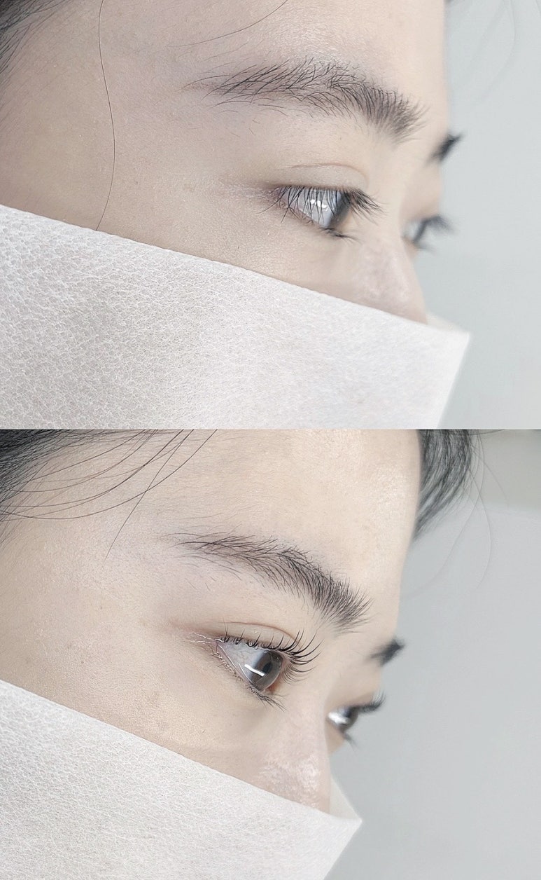 로로아로 이미지