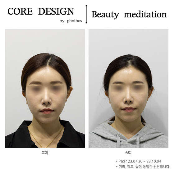 포이보스 이미지