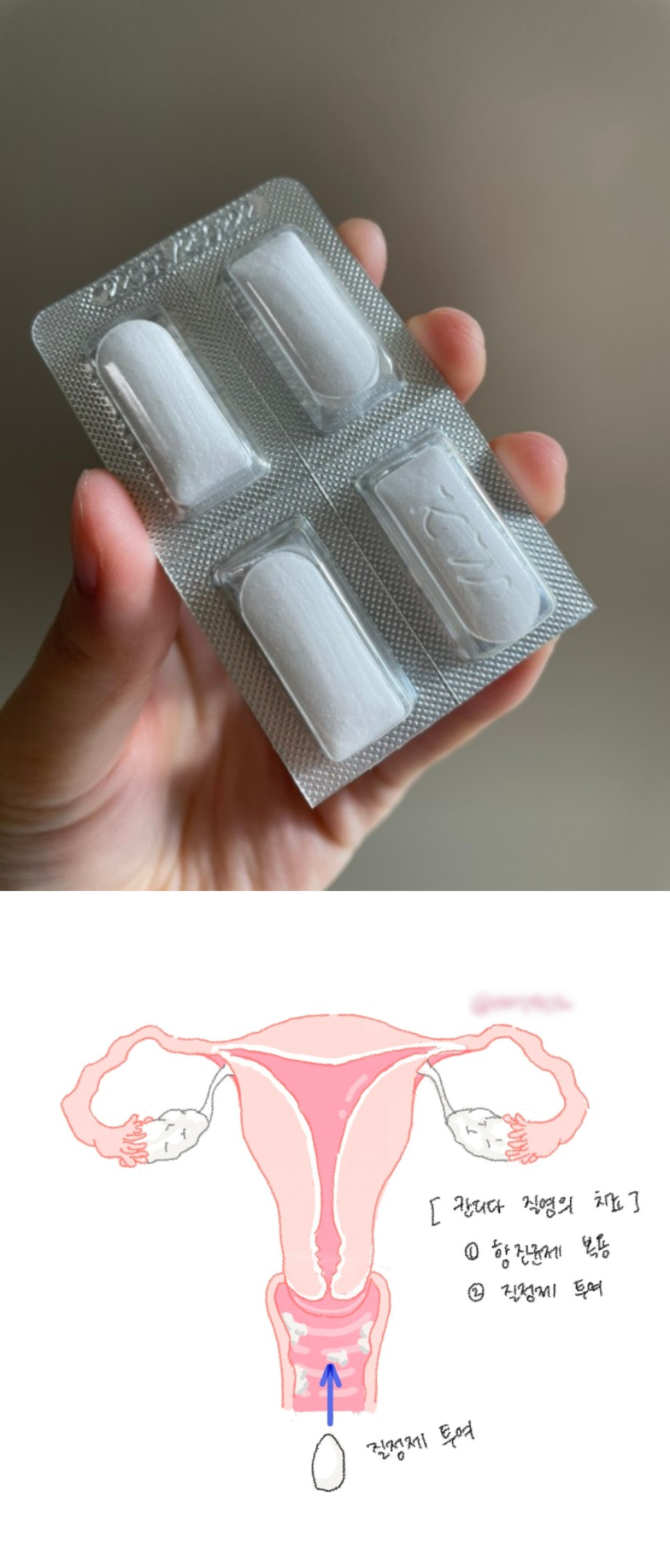 문영환산부인과 이미지