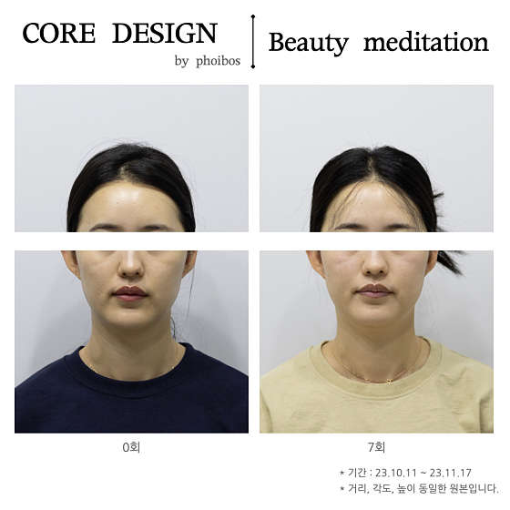 포이보스 이미지