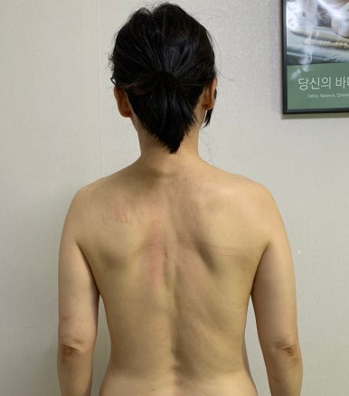 더 휴 스킨케어 이미지