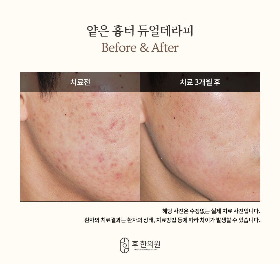 오송한의원 이미지