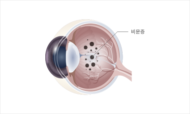 서울닥터윤치과 이미지