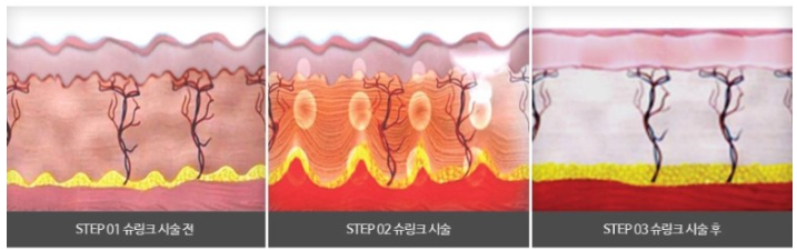 (주)피스콜 이미지
