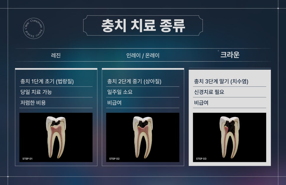 양심치과가 말해주는 충치 치료 종류와 비용 [ 강남새로치과 ] 관련 이미지 7