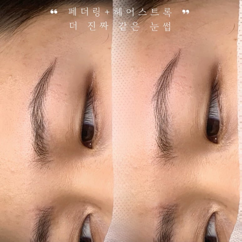 다움스킨 이미지