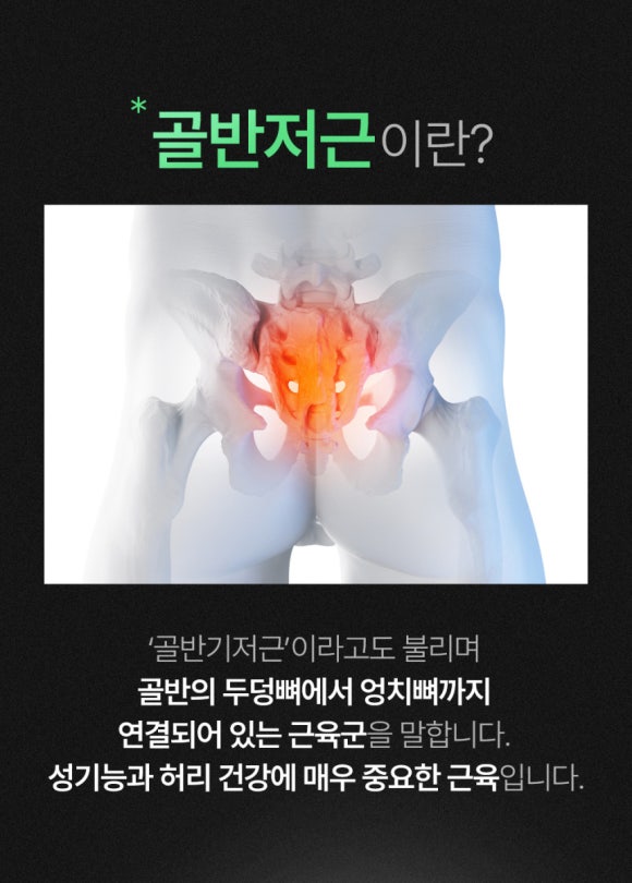 큐어핏 이미지