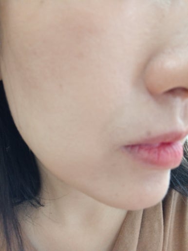 트리플쉴드 이미지