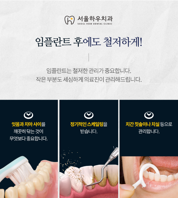 서울하우치과 이미지
