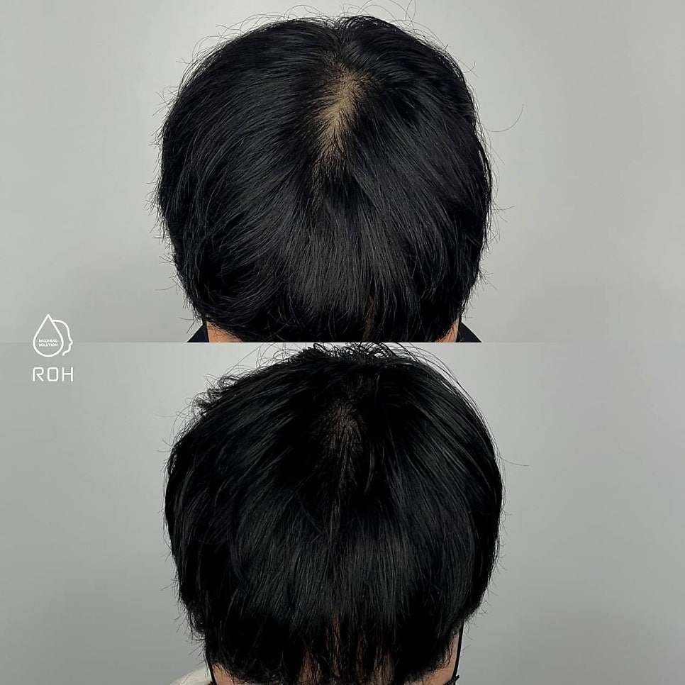 프로스칼프부산 이미지
