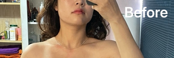 바디웨이브파동테라피 이미지
