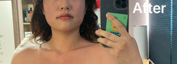 바디웨이브파동테라피 이미지
