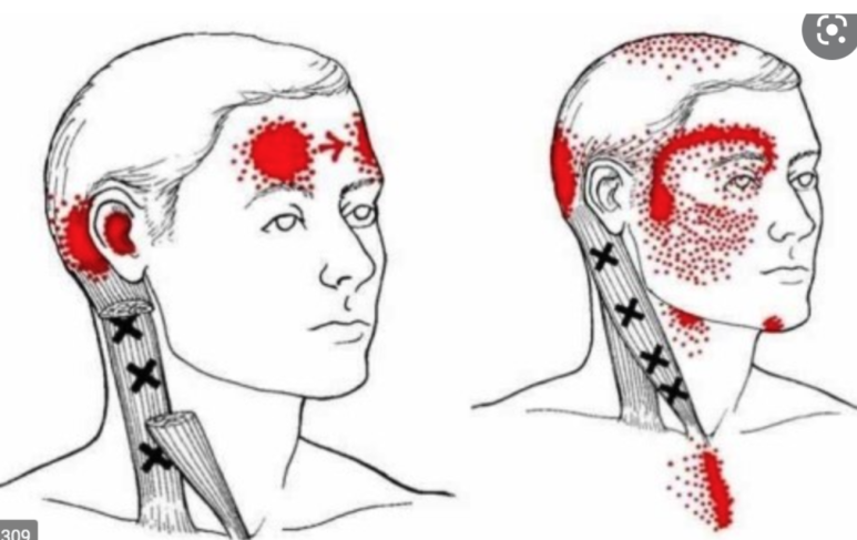 레드포인트파트너스 이미지