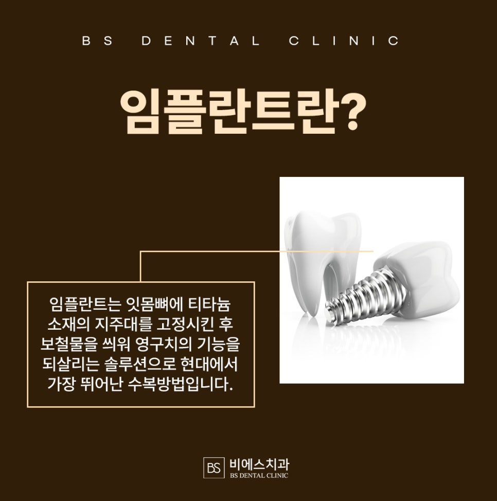 비에스브릿지 이미지