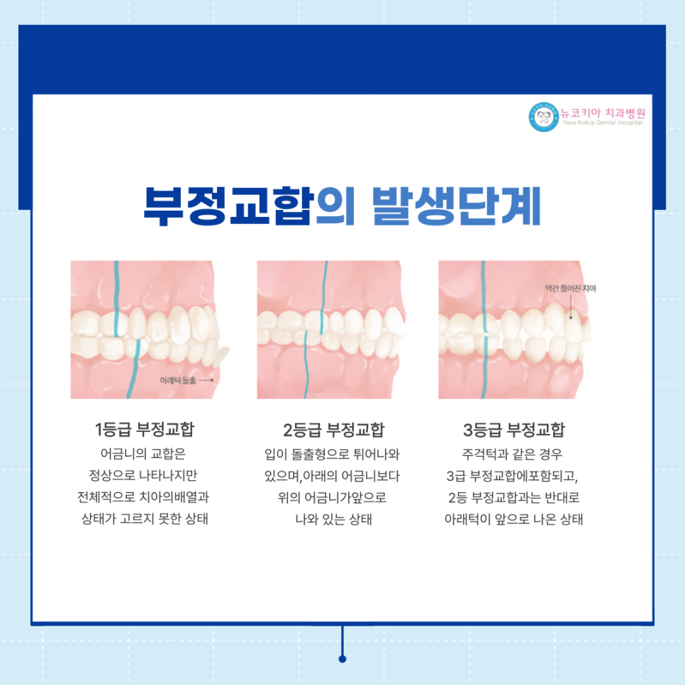 뉴코키아치과병원 이미지