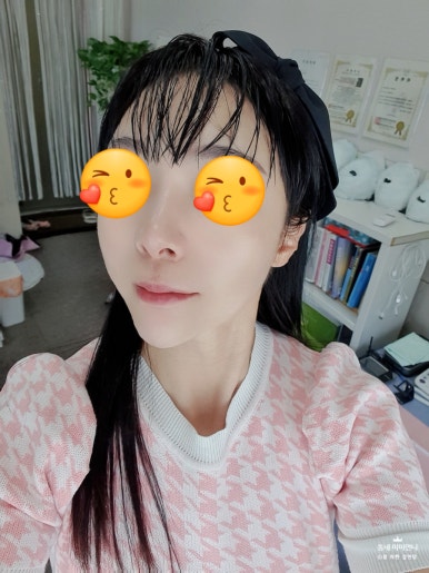 피부날다 이미지