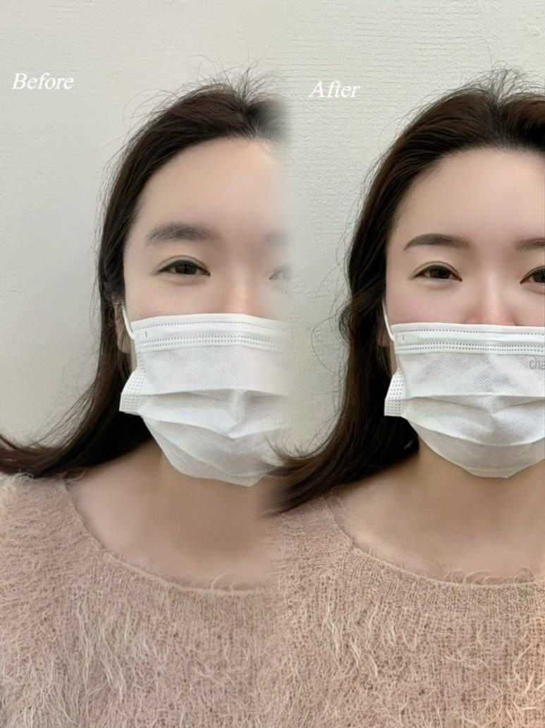 예뿐눈썹 이미지