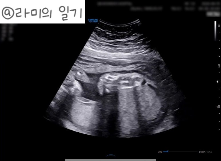샬로미 이미지