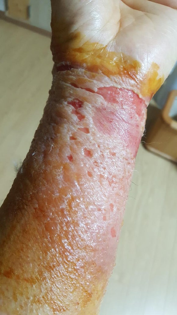 참옻지장수연구소 이미지