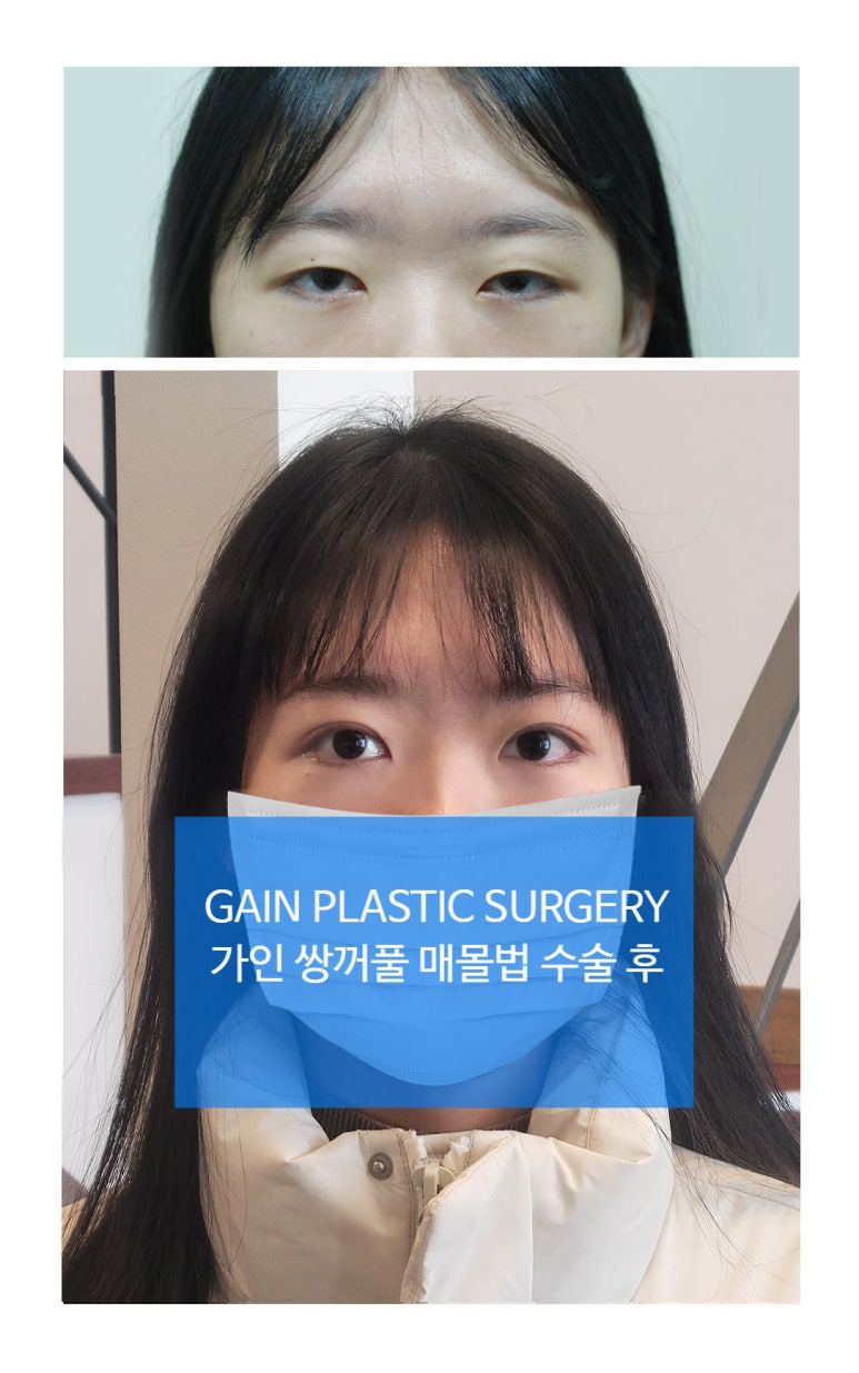 인아웃디자인 이미지