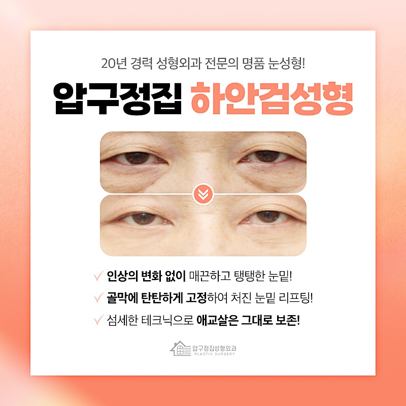 압구정집성형외과 이미지