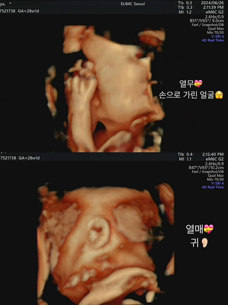 열매열무2 이미지