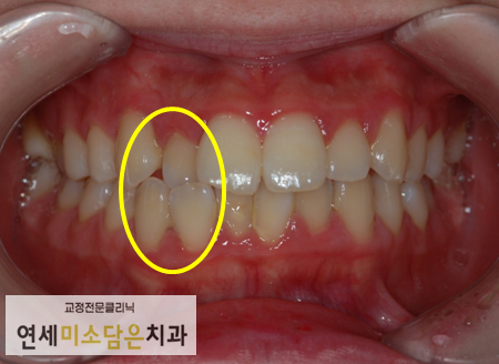 연세미소담은치과 이미지