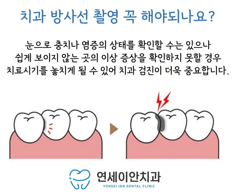 연세이안치과 이미지