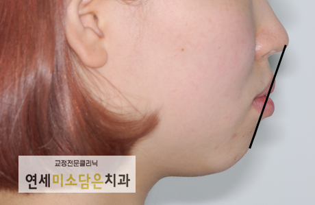 연세미소담은치과 이미지
