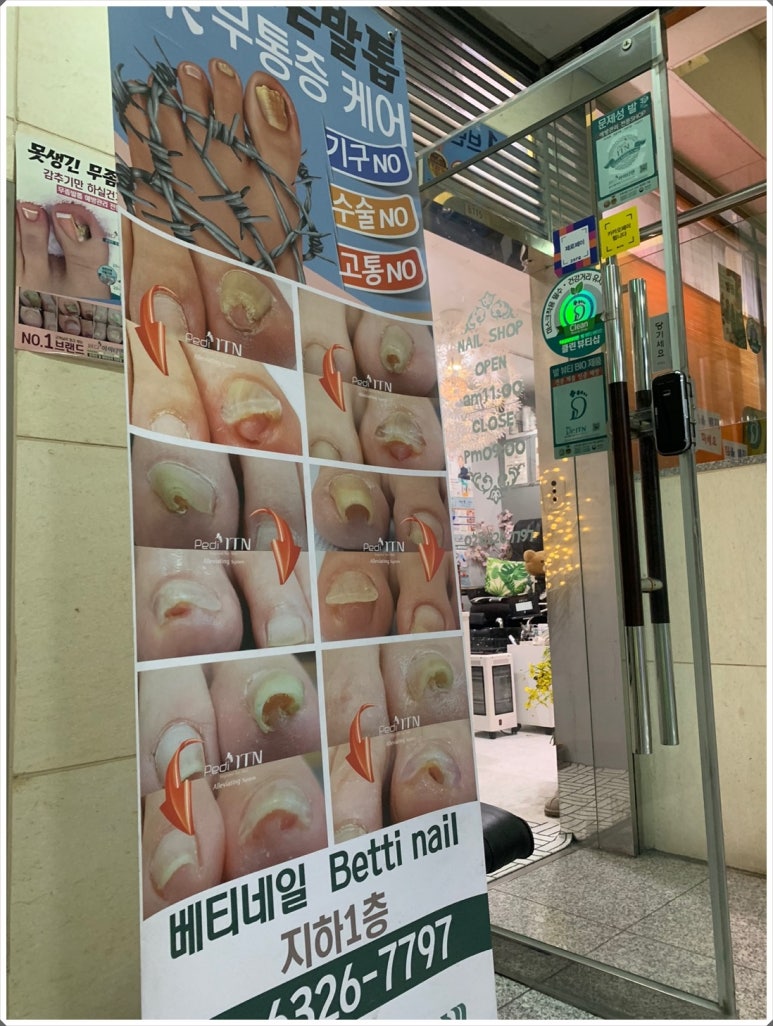 베티네일 이미지