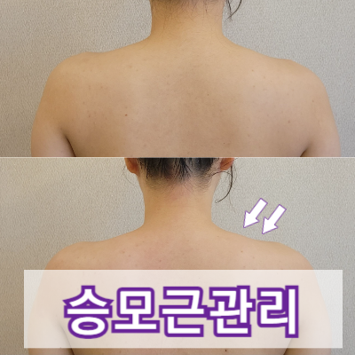 365뷰티라인 이미지