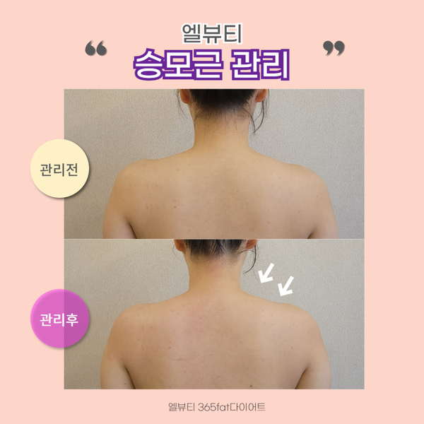 365뷰티라인 이미지