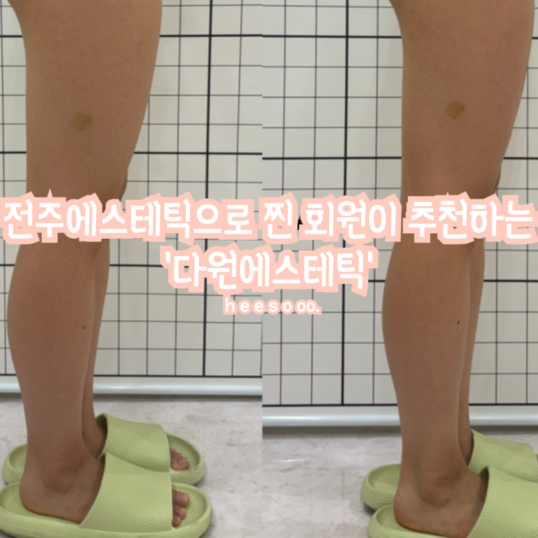 H.S에스테틱 이미지