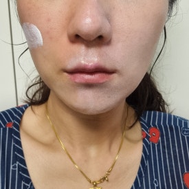 바른선 테라피 이미지
