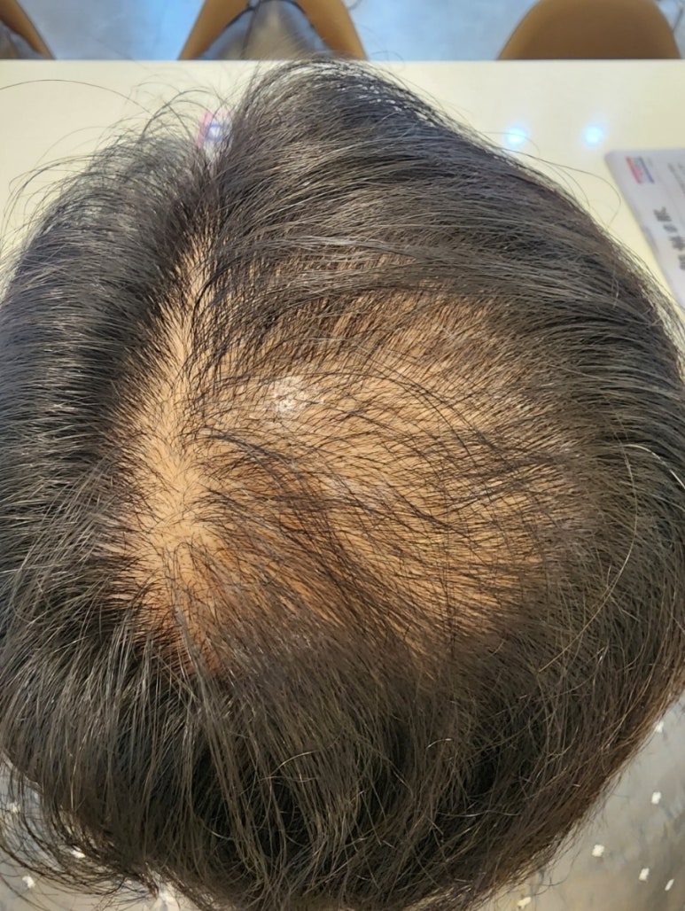 라비쏘헤어 이미지