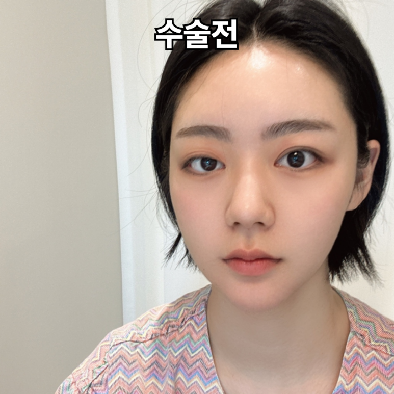 아이그램성형외과 이미지