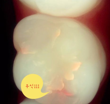 연세진정한치과 이미지