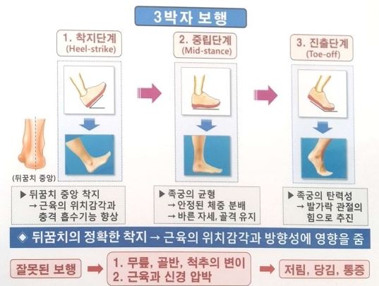 알즈너대한 이미지