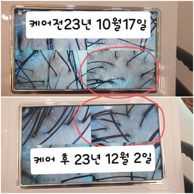 두피탈모태후사랑아주점 이미지