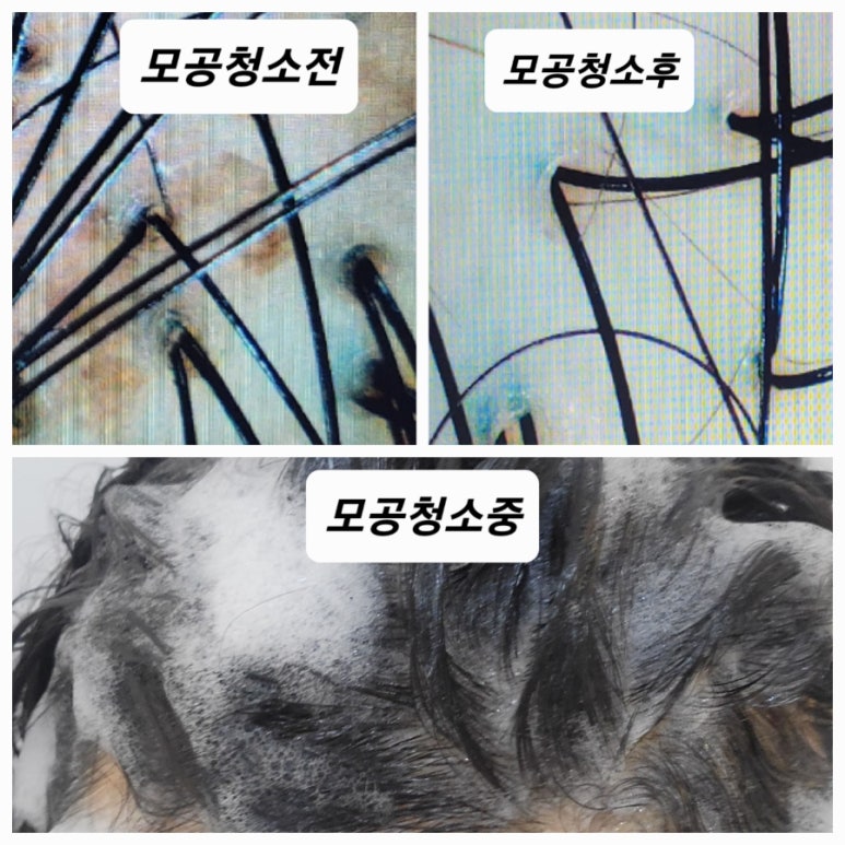 두피탈모태후사랑아주점 이미지