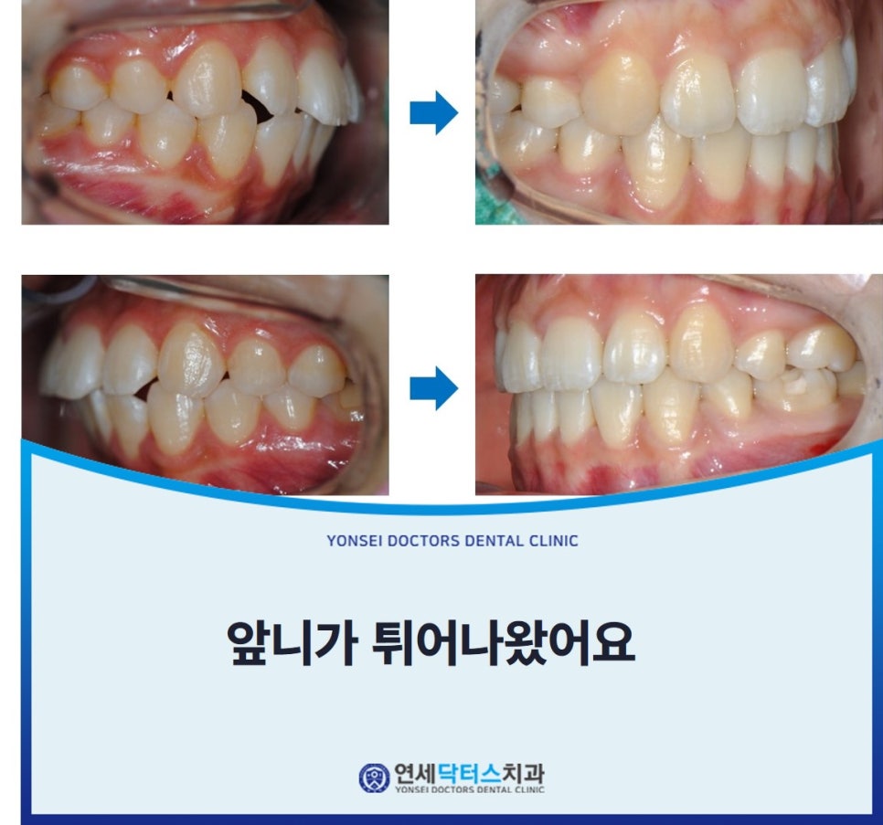 연세웃는치과의원 이미지