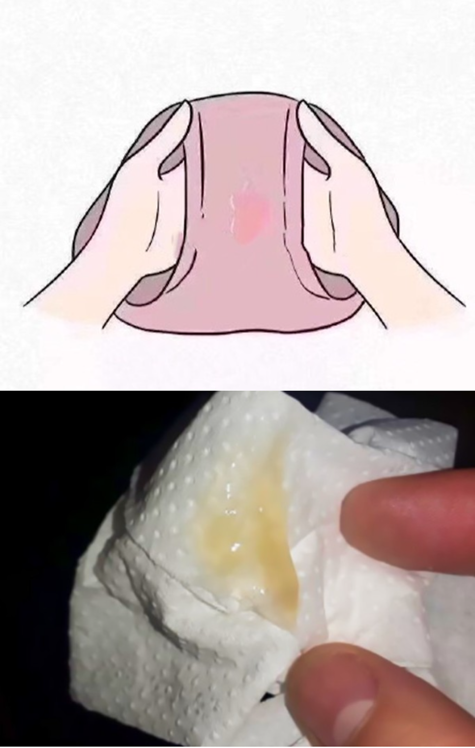 소피마르소산부인과 이미지