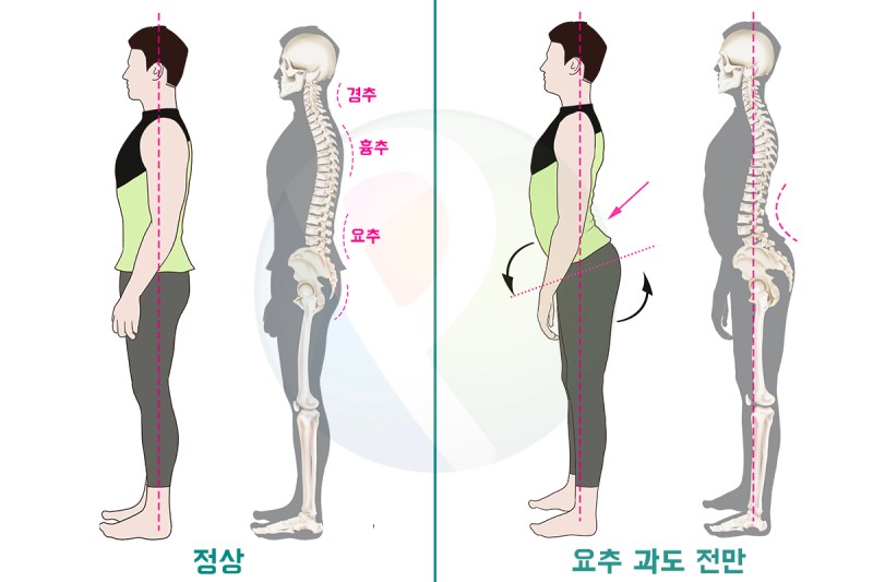 훈짐 이미지