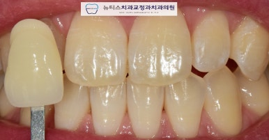뉴티스치과교정과치과의원 이미지