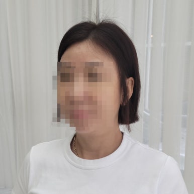 다연헤어라인 이미지