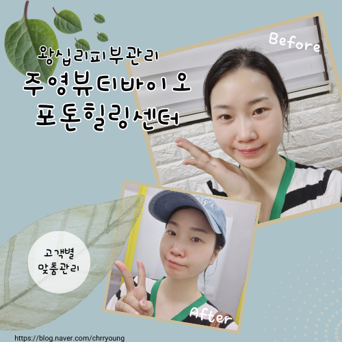 힐링포톤 이미지