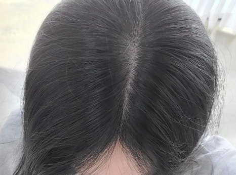 도트바이림 이미지