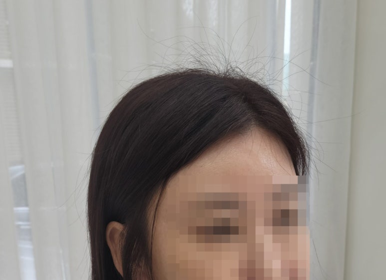 다연헤어라인 이미지