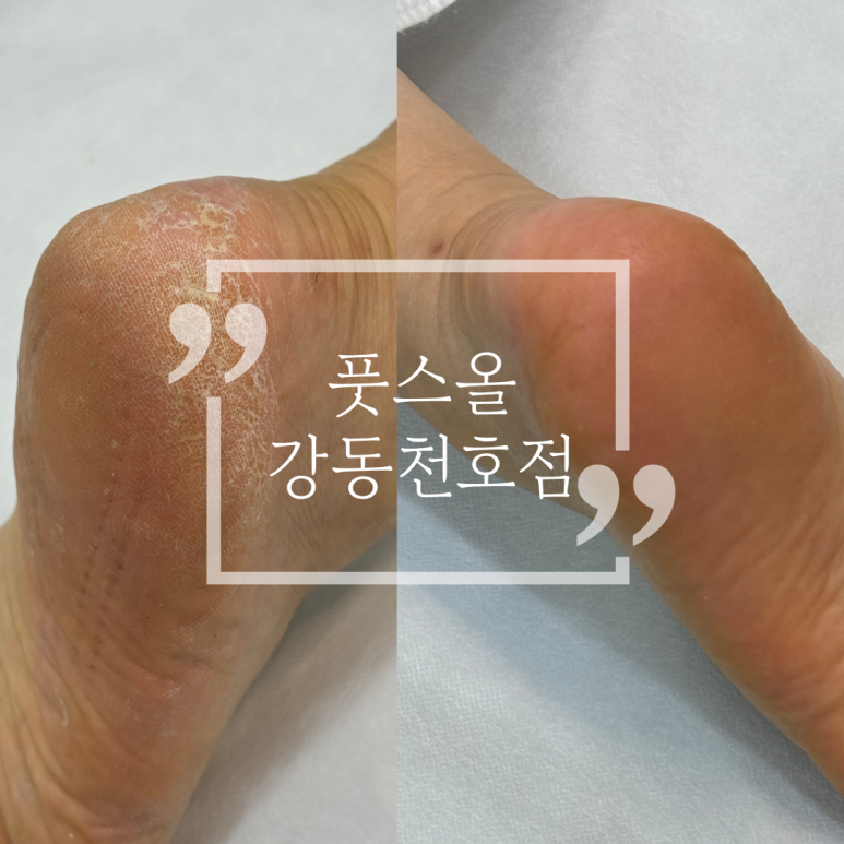 풋스올 강동천호점 이미지