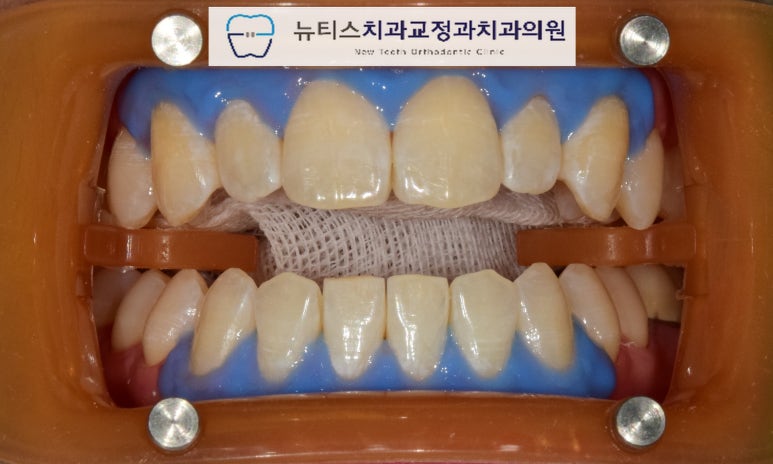 뉴티스치과교정과치과의원 이미지